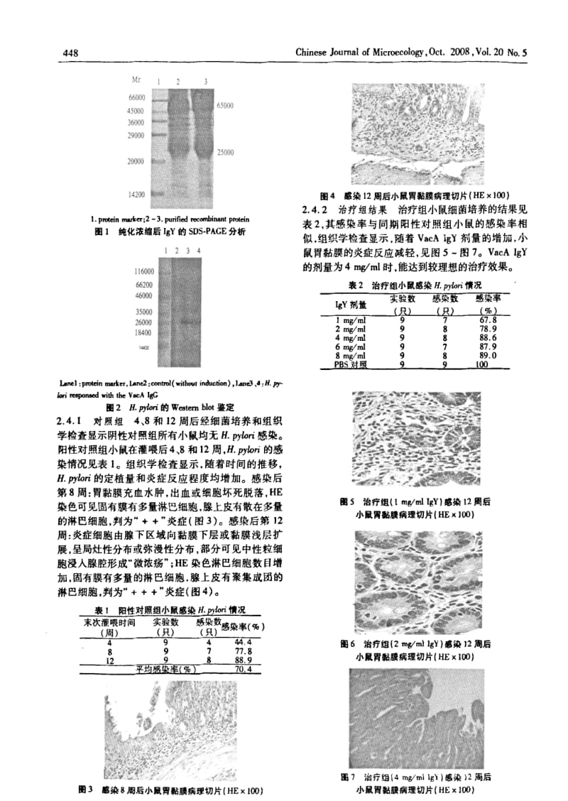 抗重组VACA IGY体内抗幽门螺杆菌感染的实验研究.pdf_第3页