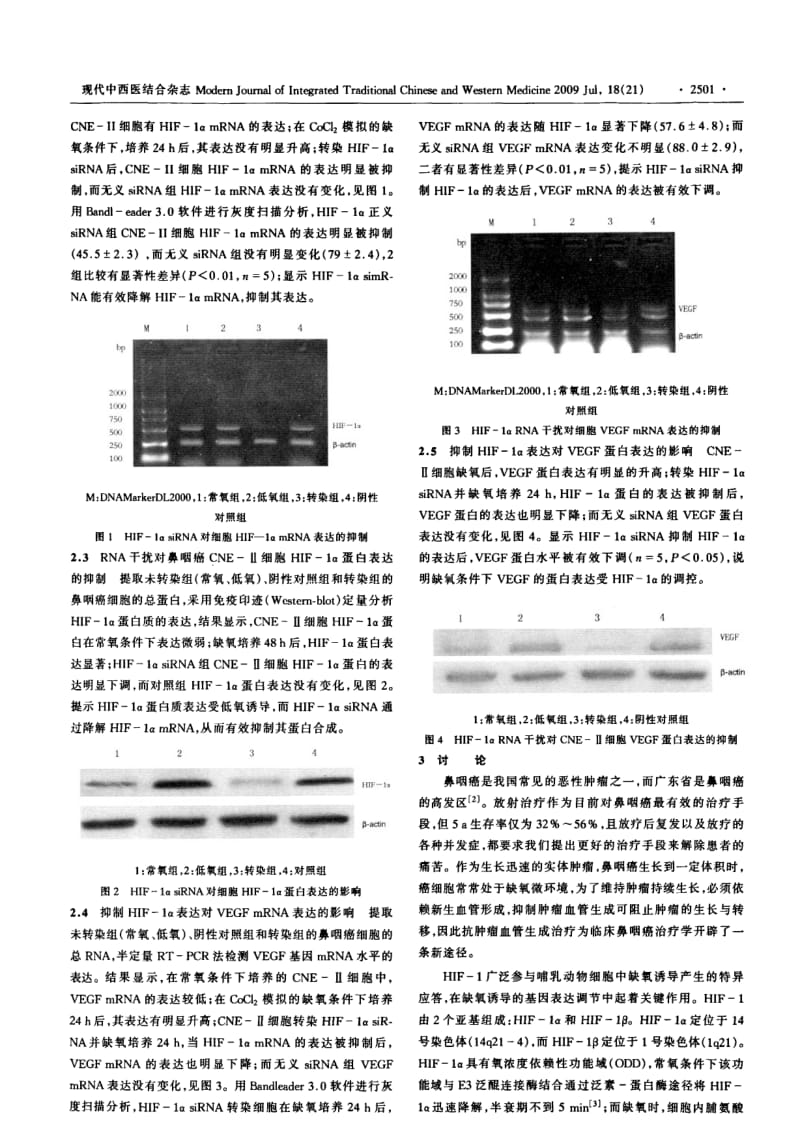 SIRNA沉默HIF-1α在缺氧状态下对鼻咽癌细胞VEGF表达的影响.pdf_第3页