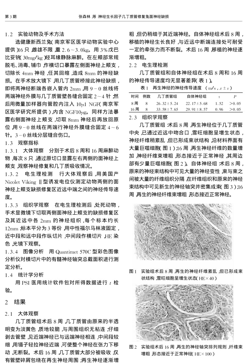 神经生长因子几丁质管修复兔面神经缺损.pdf_第2页