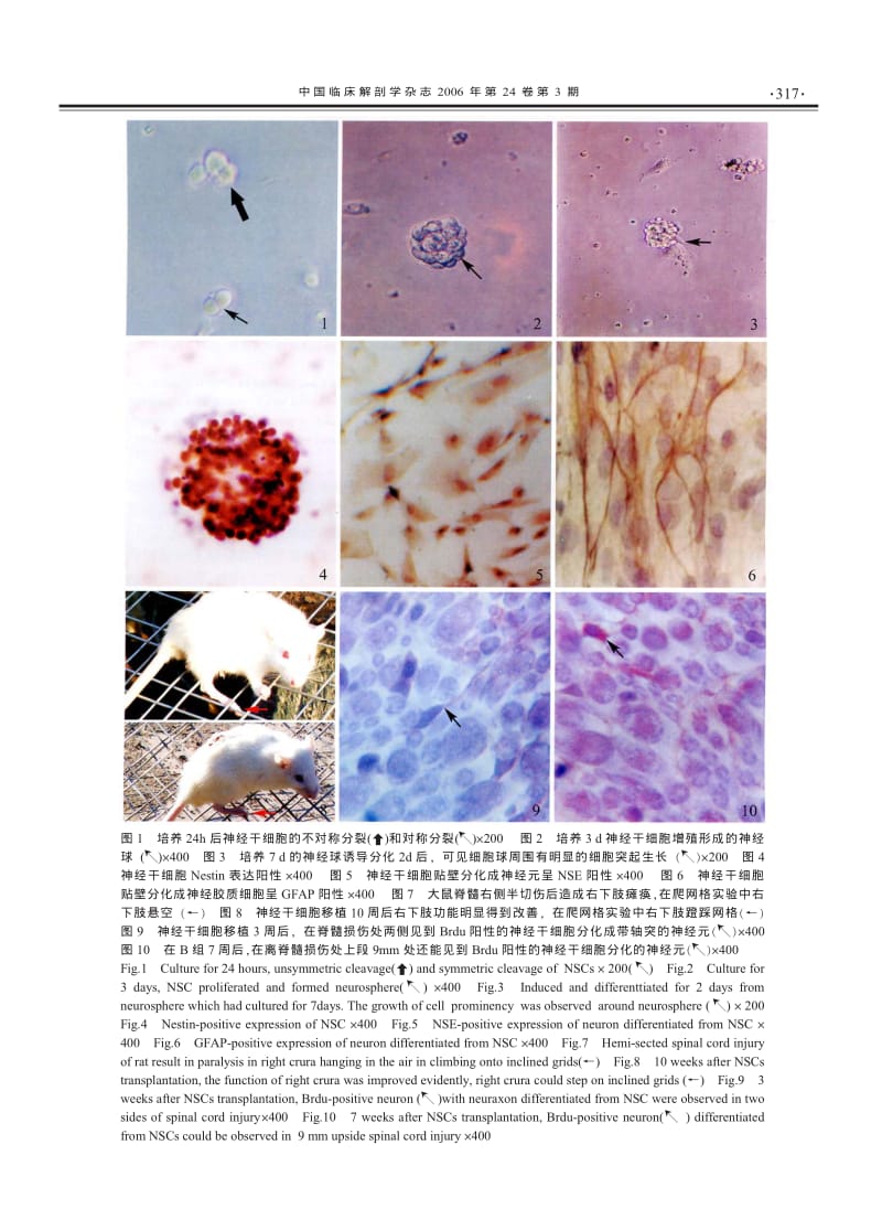 神经干细胞移植修复大鼠脊髓半切伤的研究.pdf_第3页