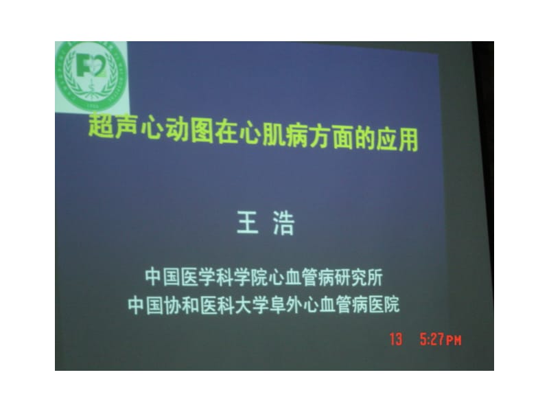 超声心动图在心肌病中应用.ppt_第1页