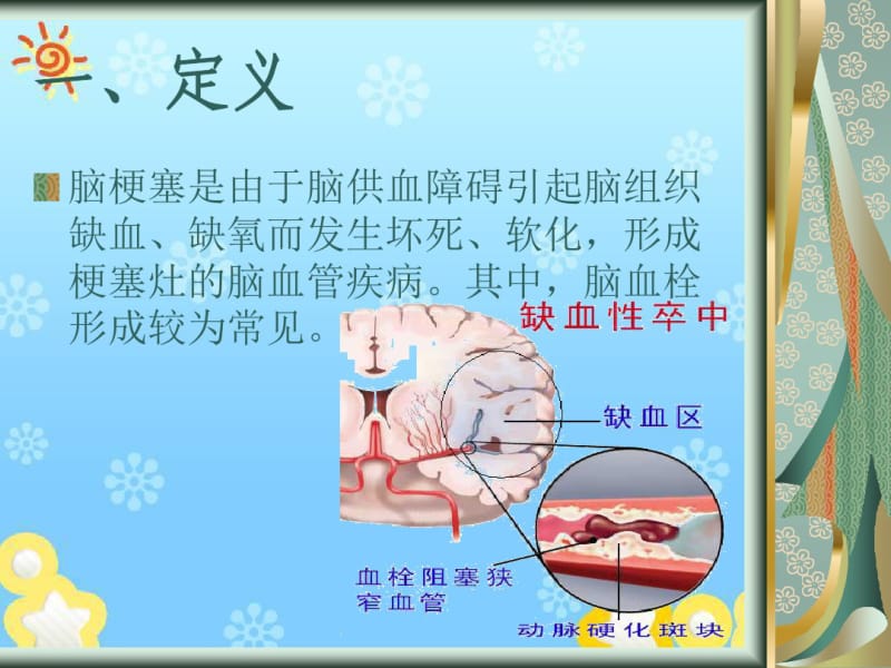 脑梗塞的护理常规.pdf_第2页