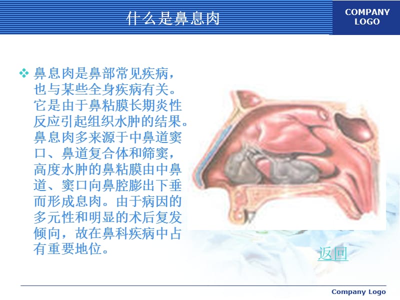 鼻息肉.ppt.ppt_第3页