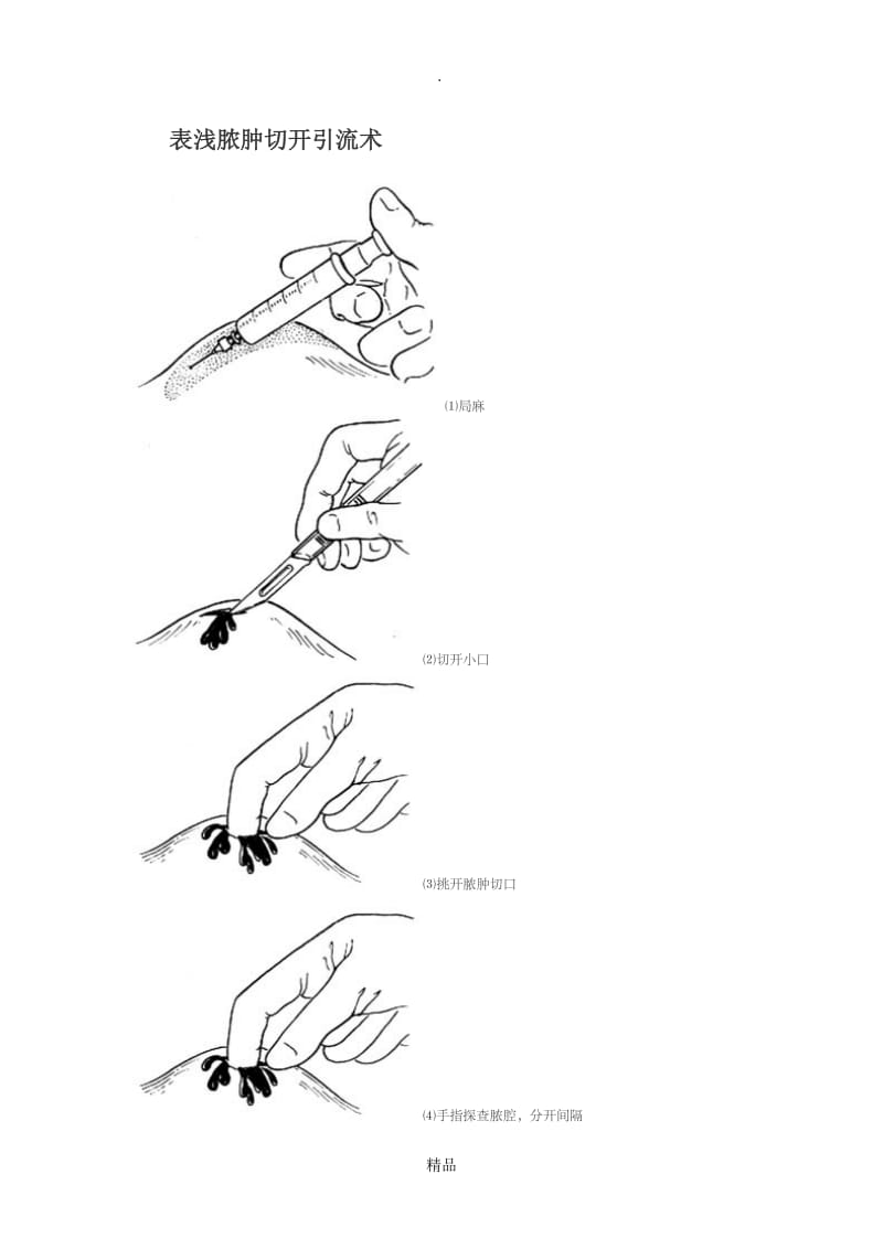 表浅脓肿切开引流术.doc_第1页