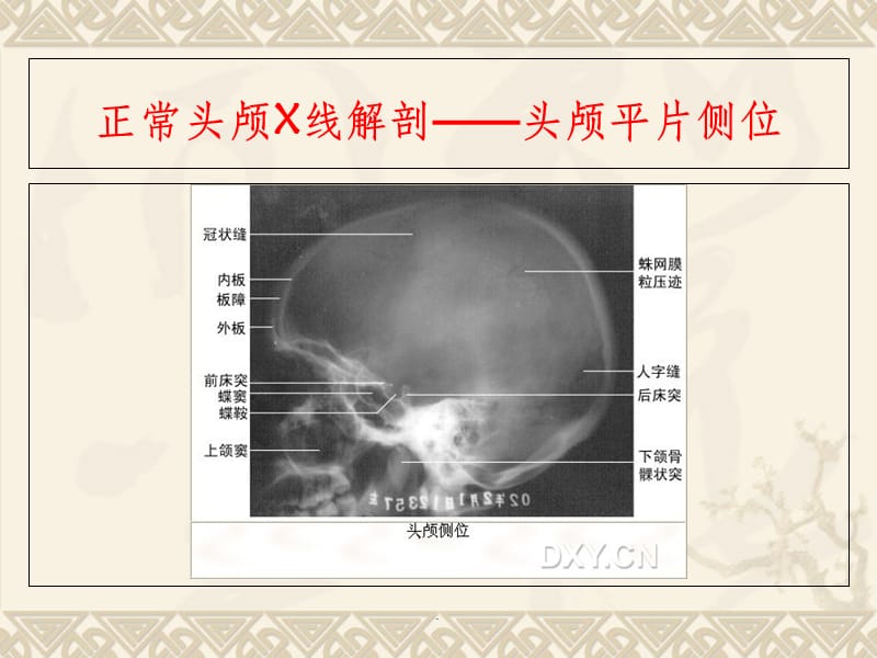 正常头颅X线解剖——头颅平片后前位.ppt_第2页