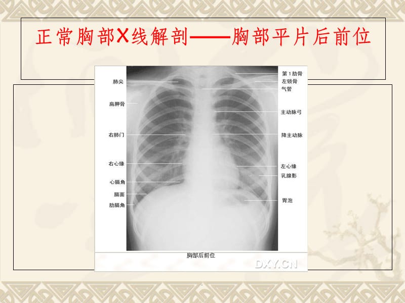 正常头颅X线解剖——头颅平片后前位.ppt_第3页