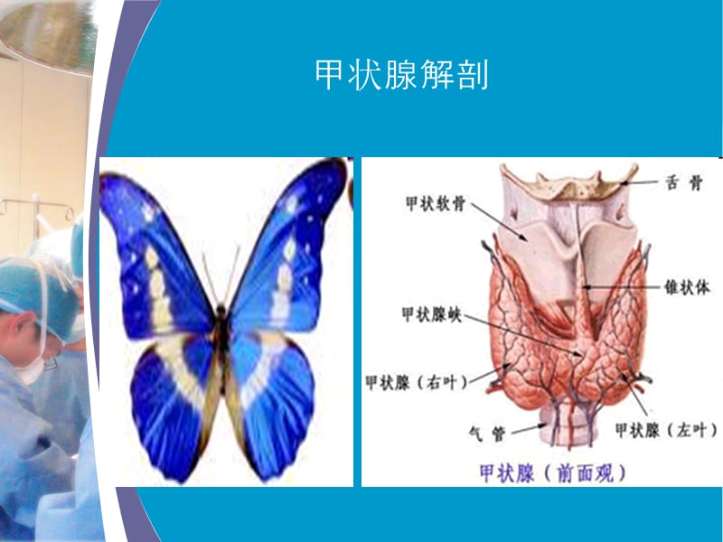 甲状腺癌根治术中喉返神经监测技术的应用；.ppt_第2页