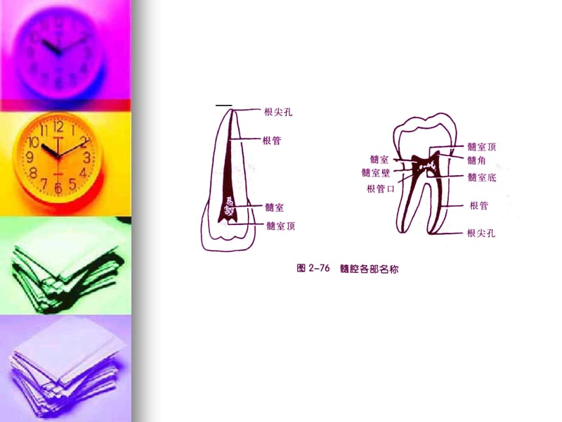 口腔牙体髓腔解剖.ppt_第3页