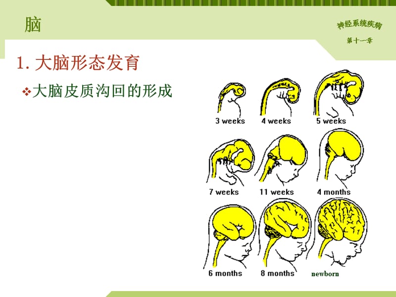 小儿神经系统解剖生理特点.ppt_第3页