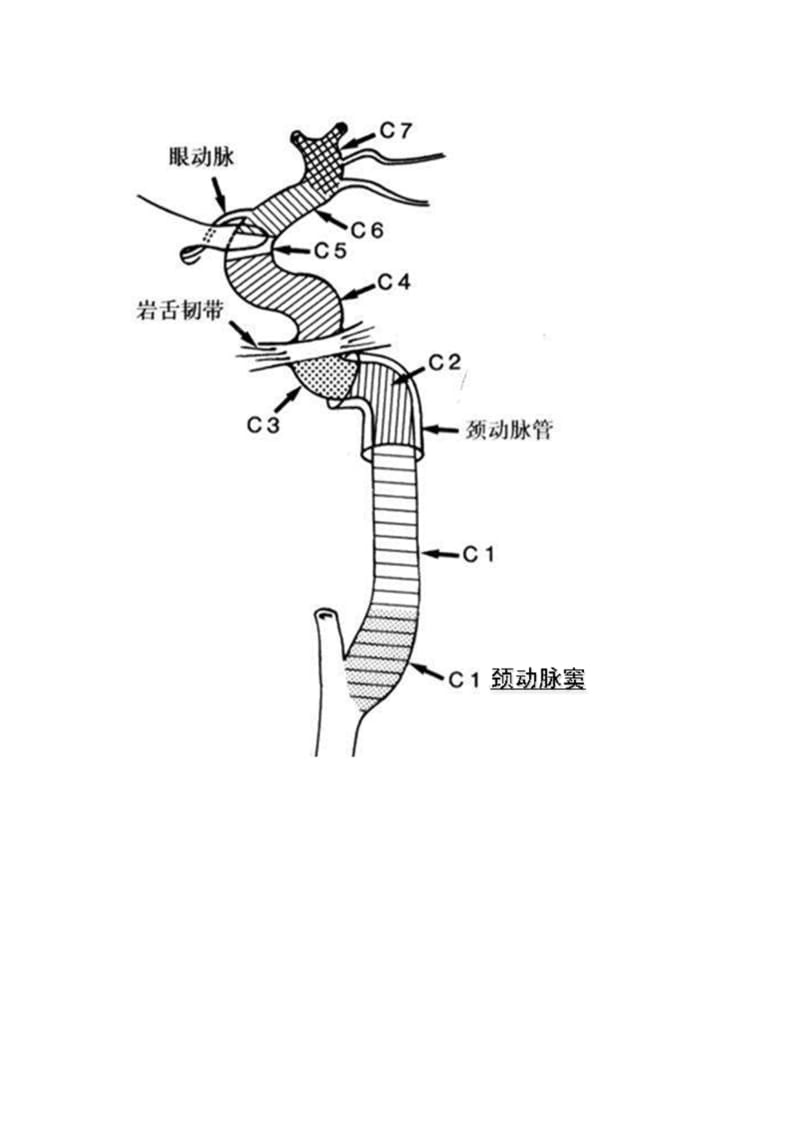 颈内动脉分段解剖.doc_第2页