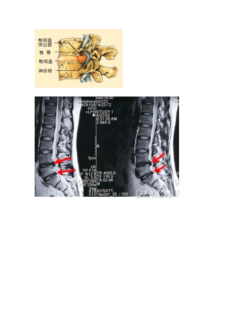 腰椎间盘解剖图.doc_第3页