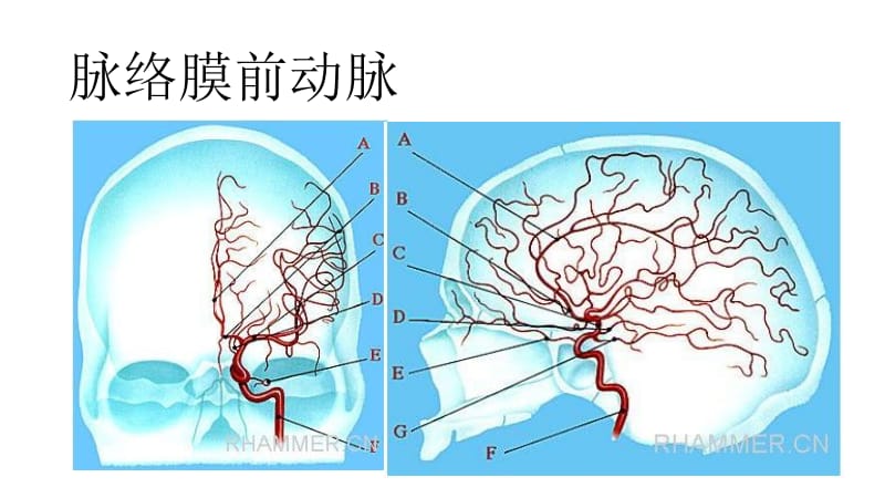 脑动脉解剖及临床(脉络膜前动脉).ppt_第2页