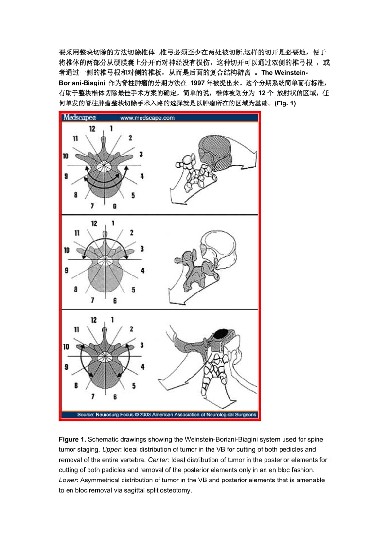 胸腰段椎体肿瘤全椎体切除的原理和技术.doc_第2页