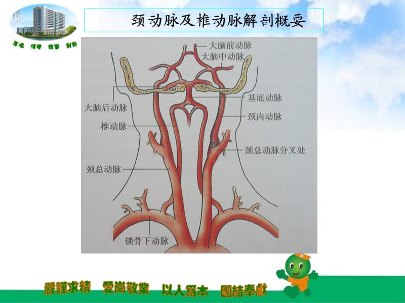 锁骨下动脉盗血;.ppt_第2页