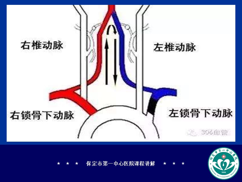 锁骨下静脉立体解剖图;.ppt_第3页