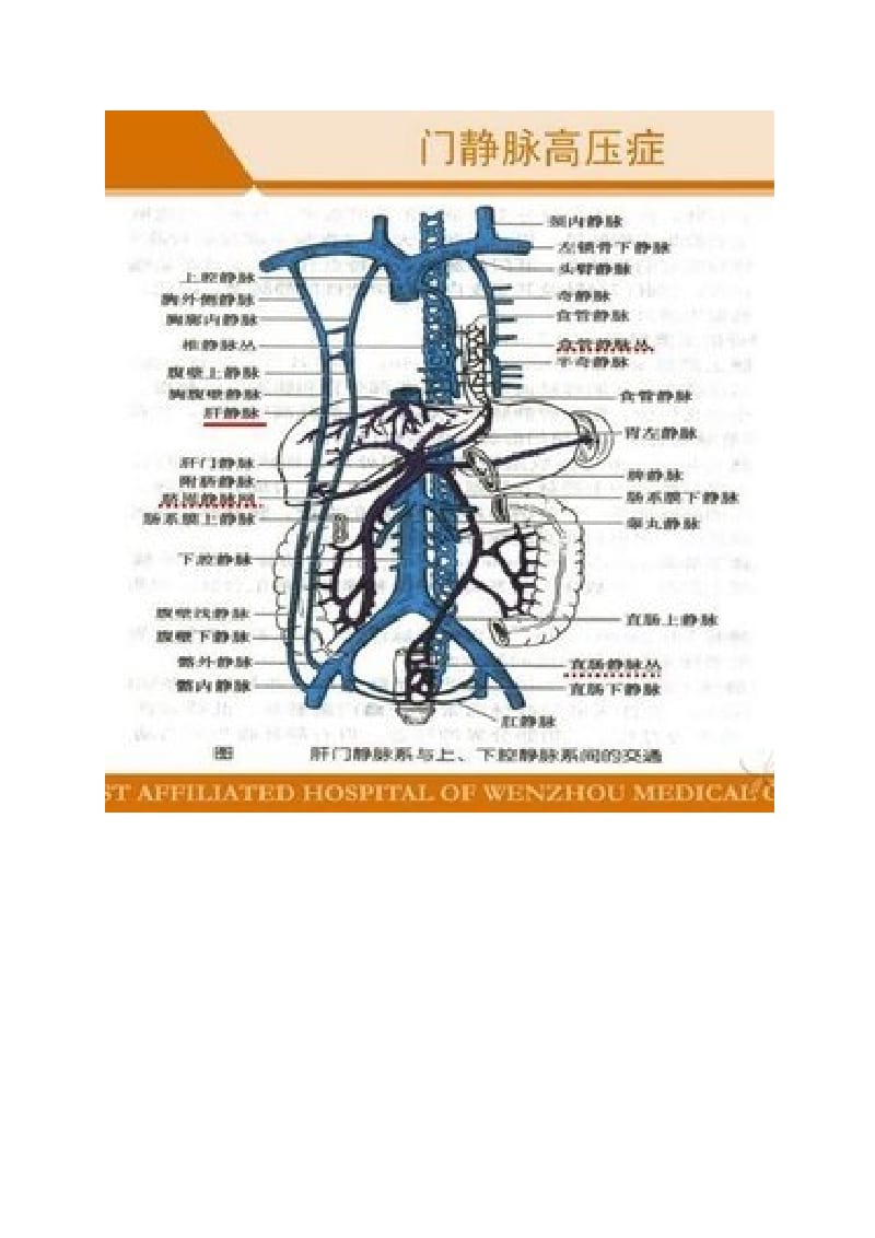 肝硬化门脉高压侧支循环形成.doc_第2页