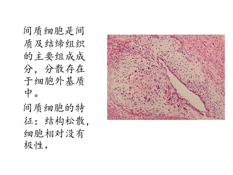 肿瘤上皮间质转化;.ppt_第3页