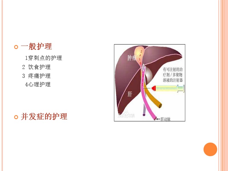 TACE术后护理;.ppt_第2页