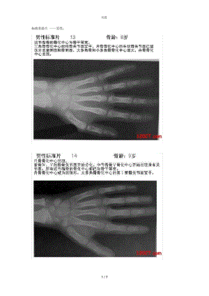 标准骨龄片.docx