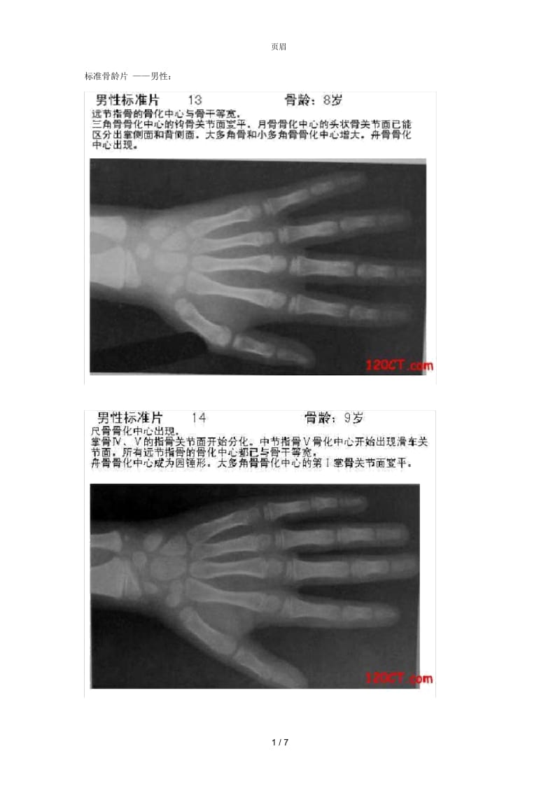 标准骨龄片.docx_第1页