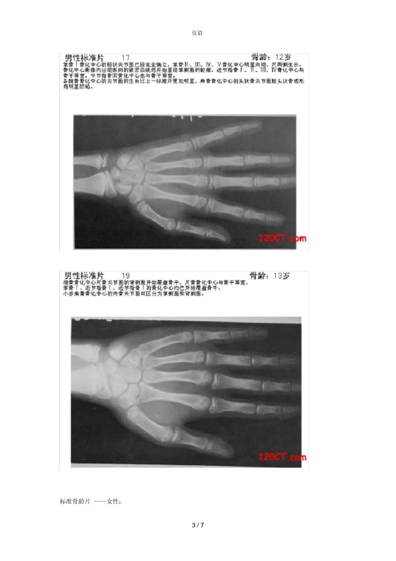 标准骨龄片.docx_第3页