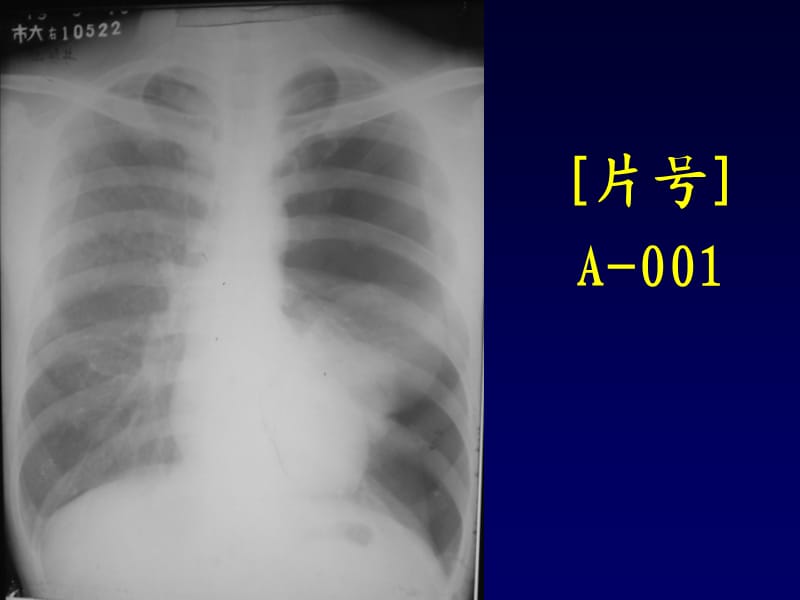 影像学X线读片考试题库.ppt_第3页