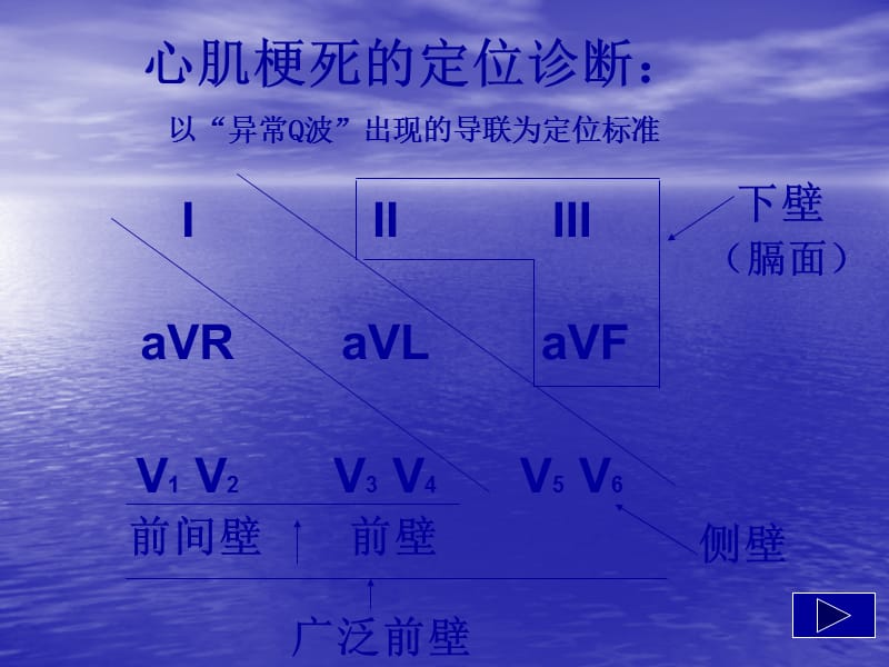 心肌梗死心电图的动态变化;.ppt_第2页