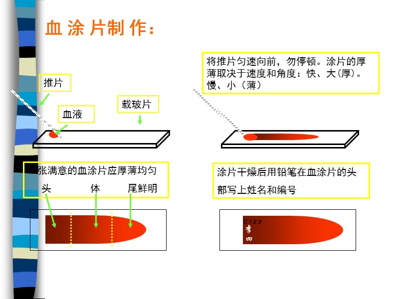 瑞氏染色;.ppt_第3页