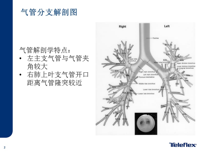 气管插管培训-双腔管.ppt_第2页