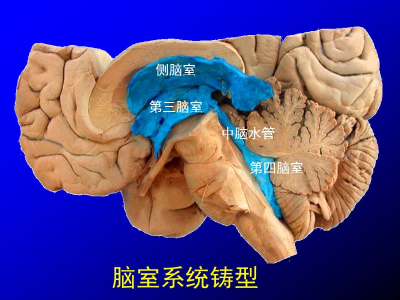 脑室、脑池应用解剖;.ppt_第2页