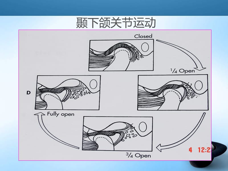 颞下颌关节紊乱MRI表现;.ppt_第2页