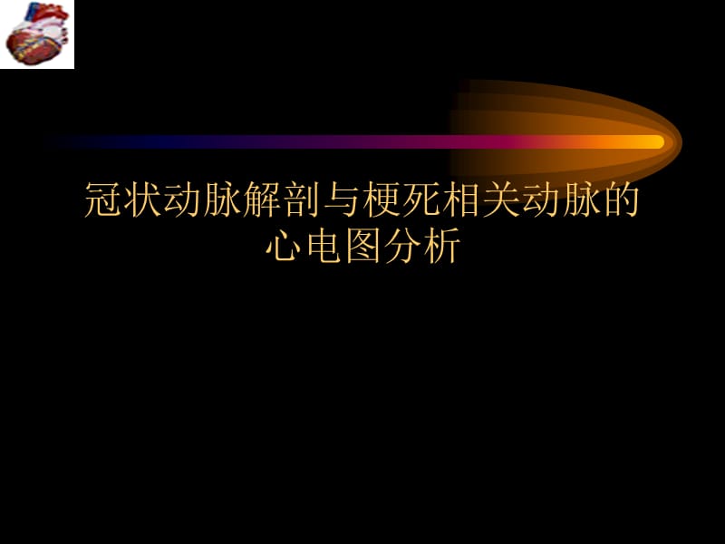 冠脉解剖与梗死相关血管心电图分析.ppt_第1页