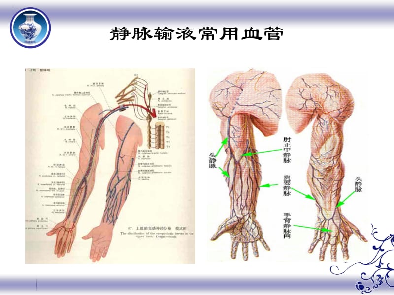 静脉炎的护理.pptx_第2页