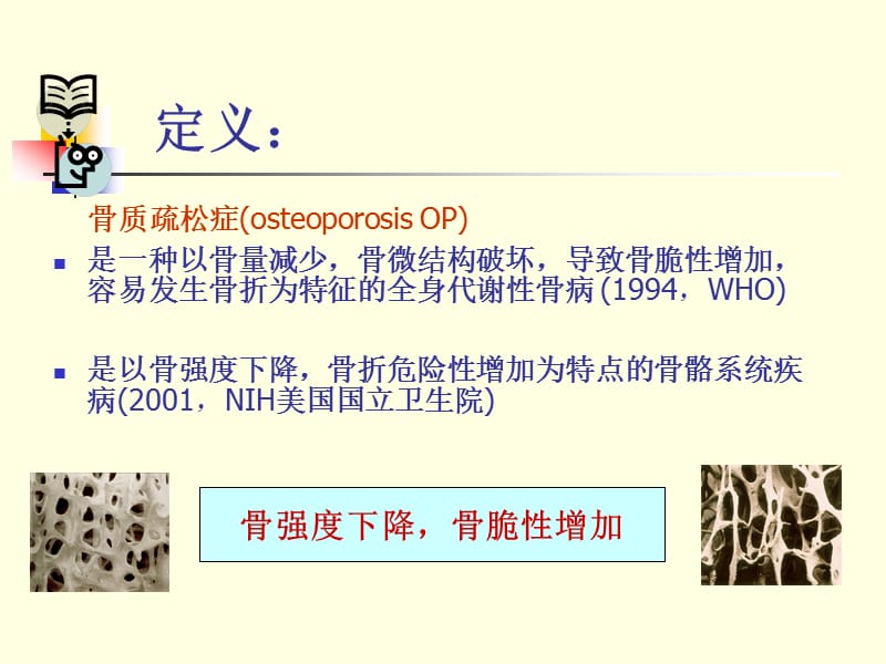 骨质疏松症诊疗指南;.ppt_第3页