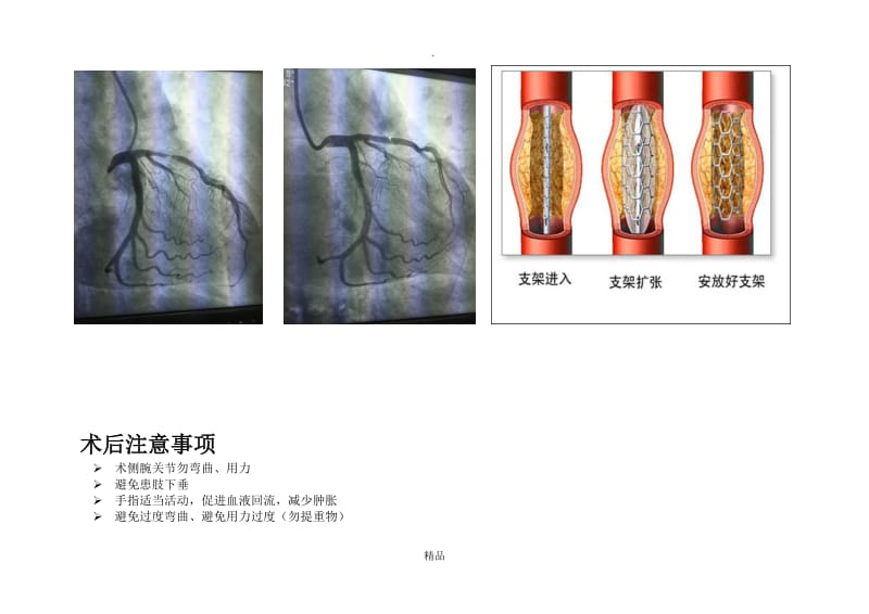 心脏介入宣传.doc_第3页