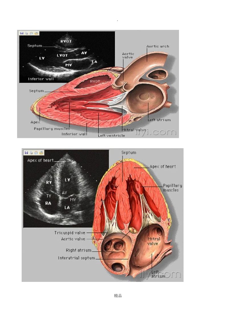 心脏彩超解读.doc_第2页