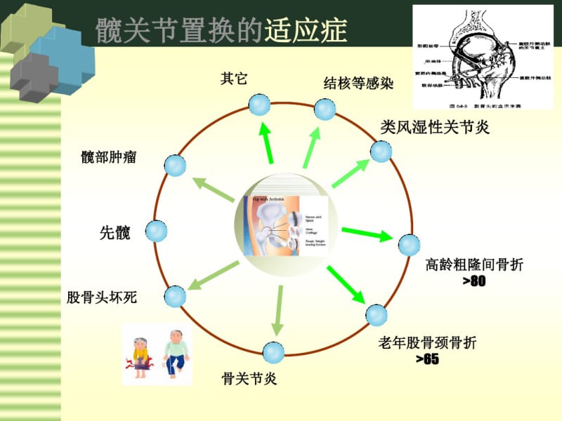 髋关节置换术后康复治疗汇总.pdf_第3页