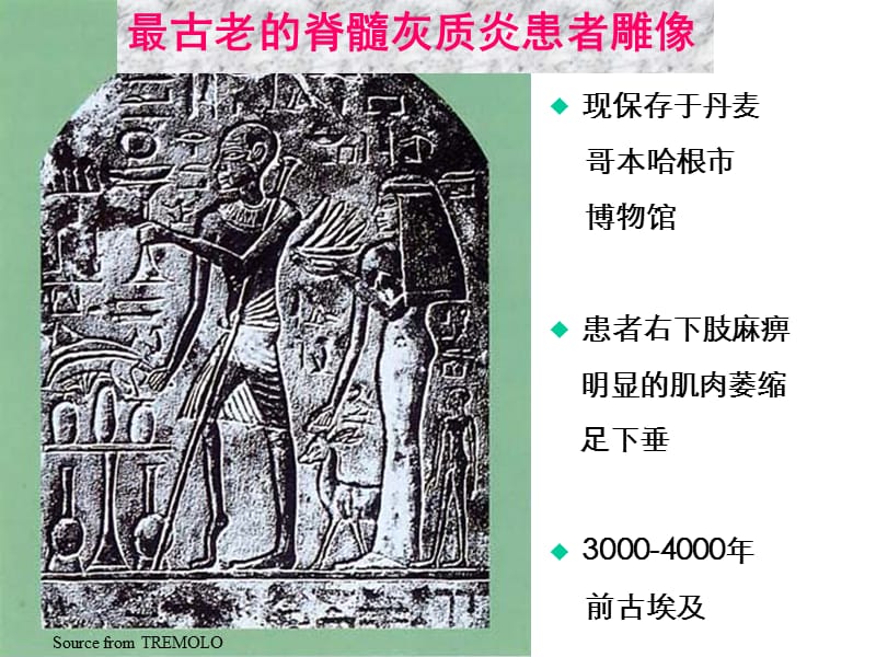 〖医学〗急性弛缓性麻痹（AFP）病例监测.ppt_第3页