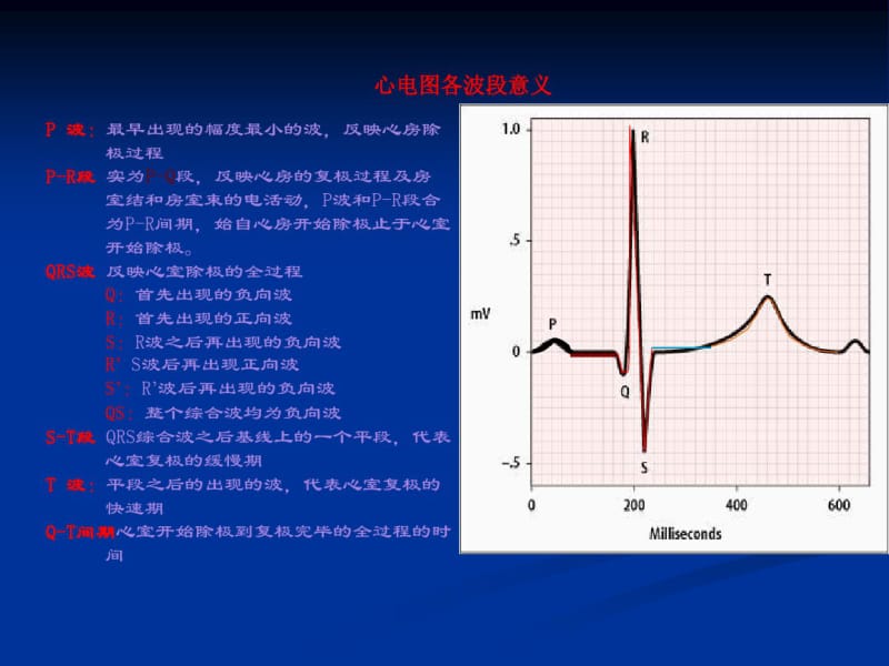 各种心电图表现.pdf_第2页