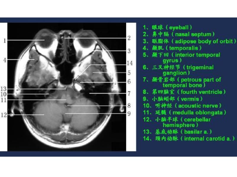 MRI常用解剖.pdf_第2页