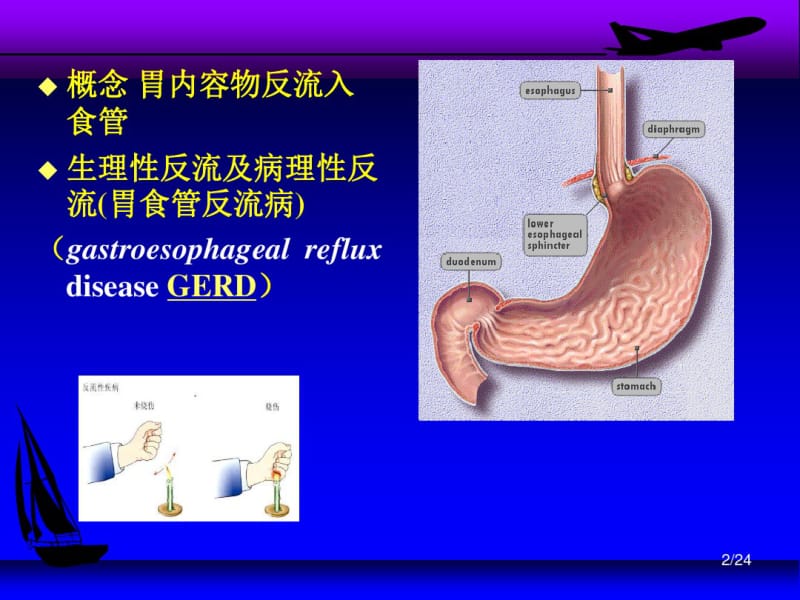 胃食管反流.pdf_第2页