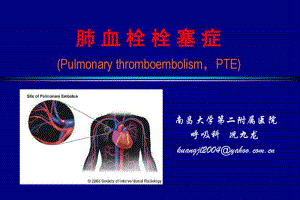 内科学肺栓塞教案.pdf