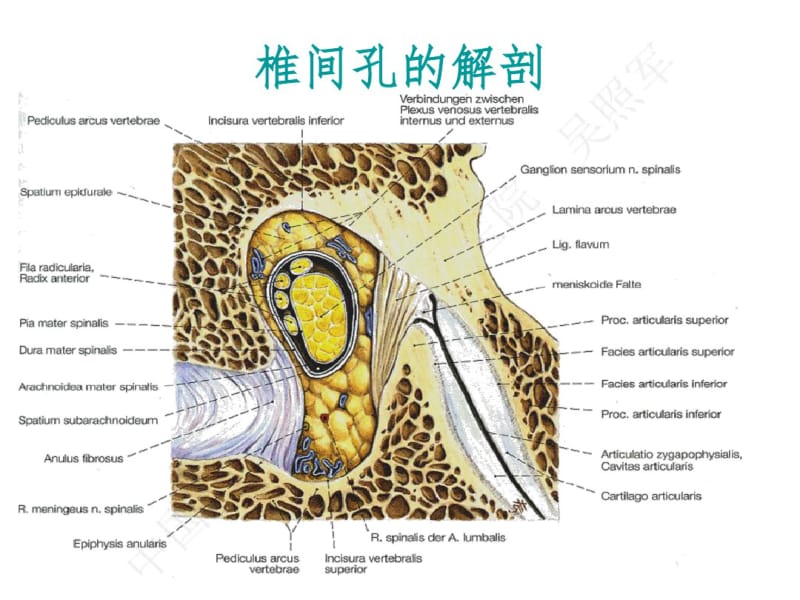 吴主任椎间孔镜课件.pdf_第3页