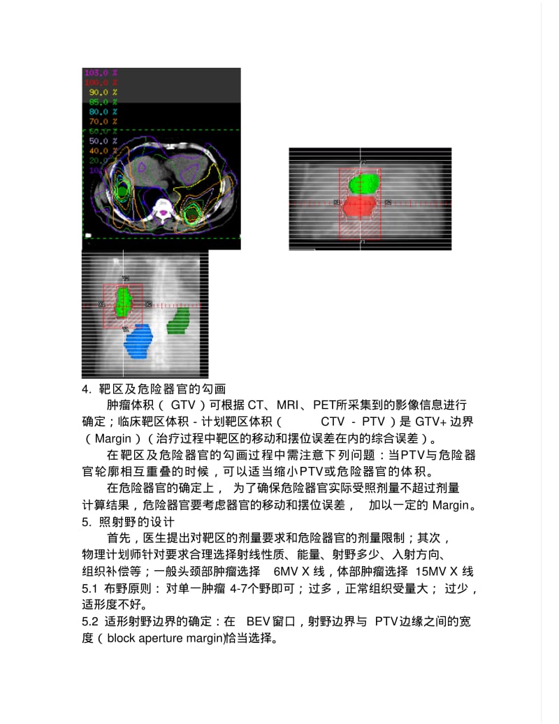 三维适形放射治疗过程流程.pdf_第3页