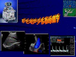 彩色超声诊断仪及彩色超声多普勒的临床应用.pdf