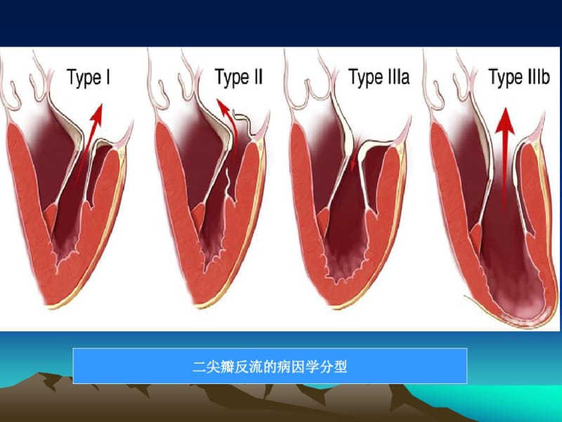 临床医生如何解读超声心动图报告之二.pdf_第3页