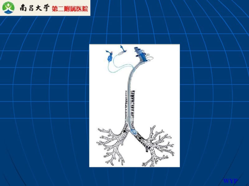 肺癌袖式切除术.pdf_第3页