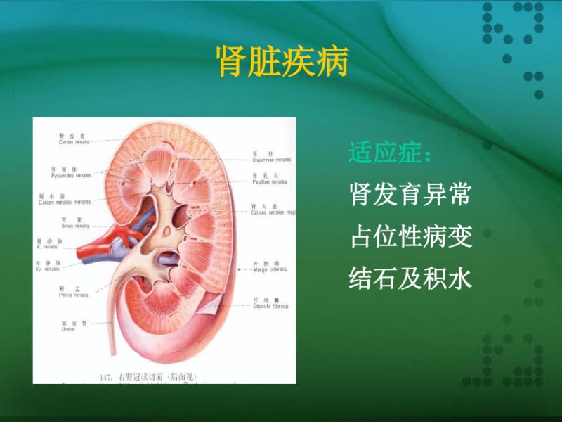 超声诊断-泌尿系统.pdf_第2页