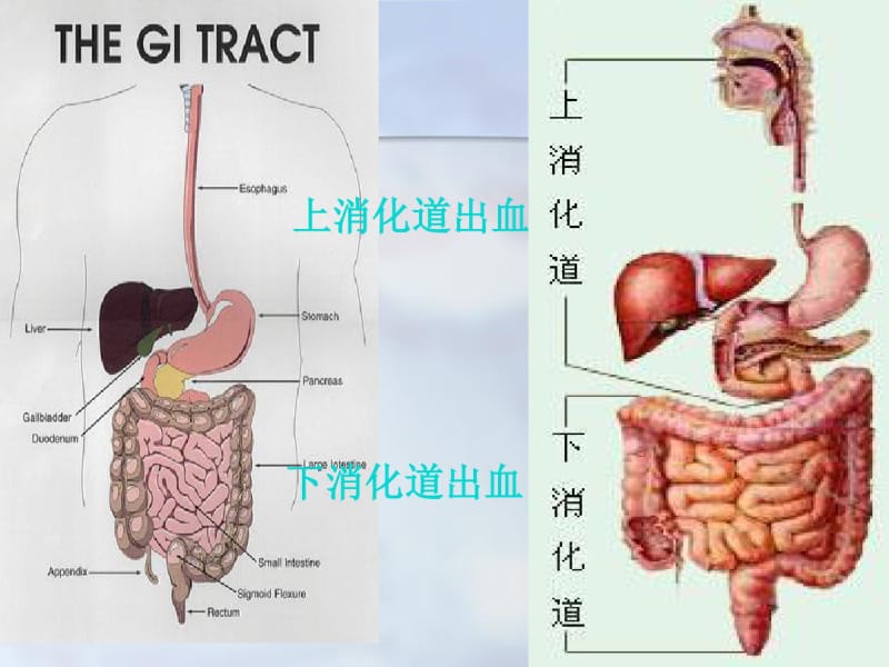 内科护理学第十二节上消化道大出血.pdf_第2页