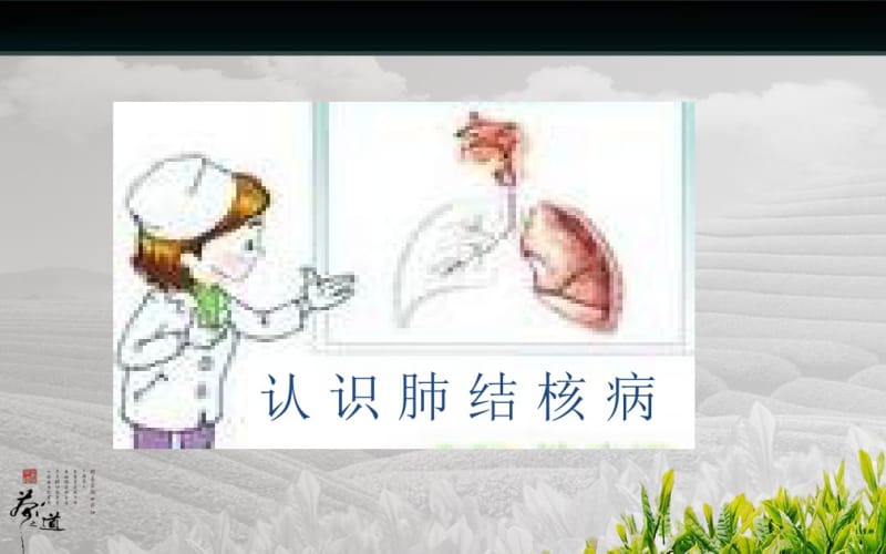 肺结核病健康指导.pdf_第2页